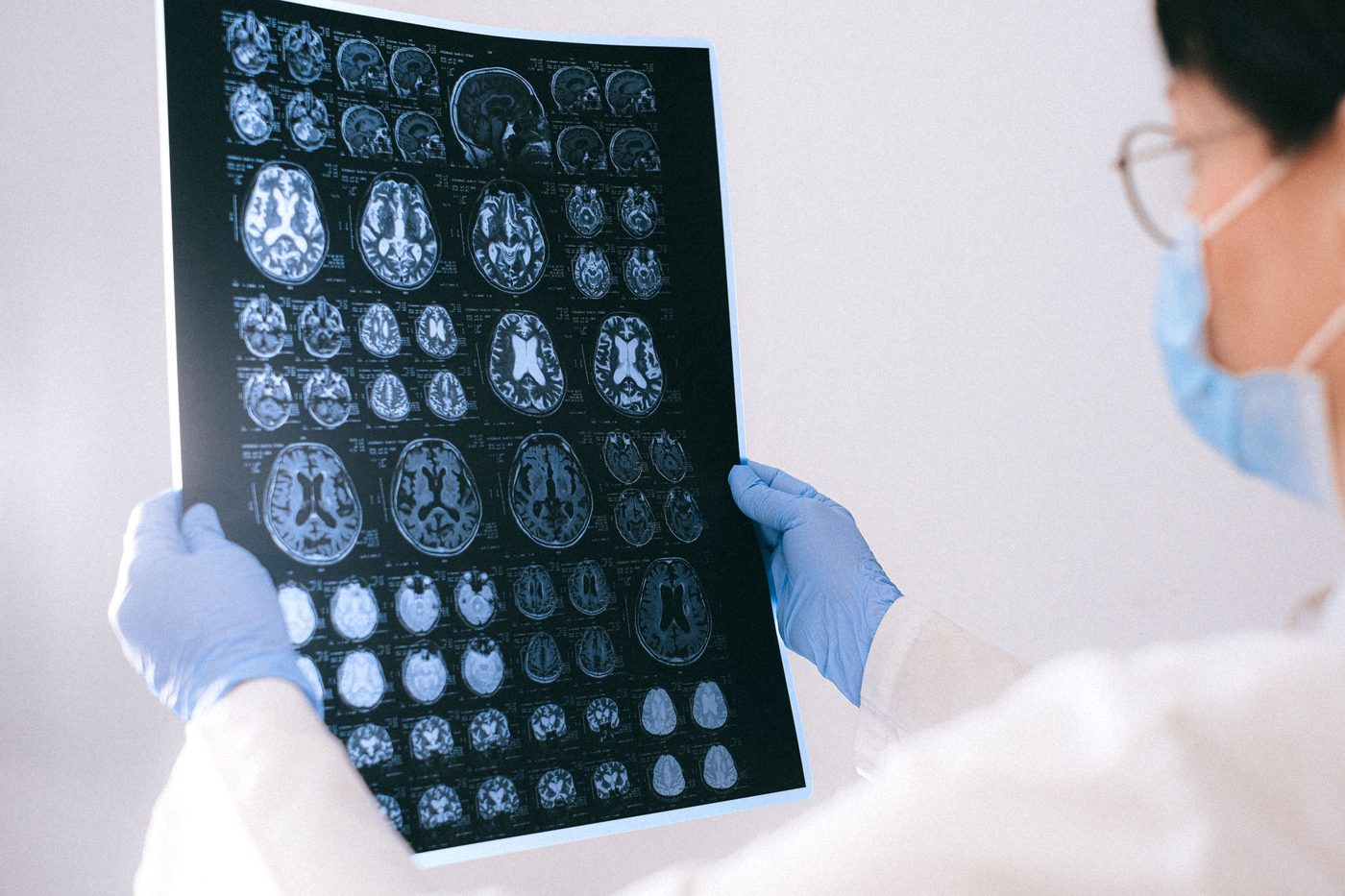 The End of Alzheimer's